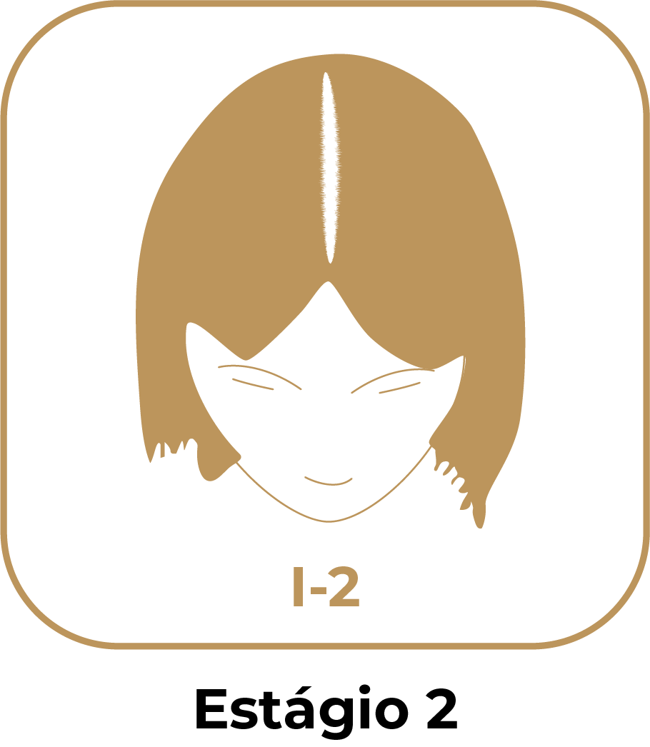 Estágio 2