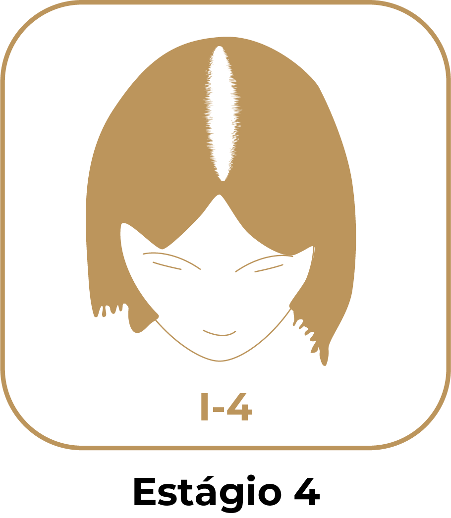 Estágio 4