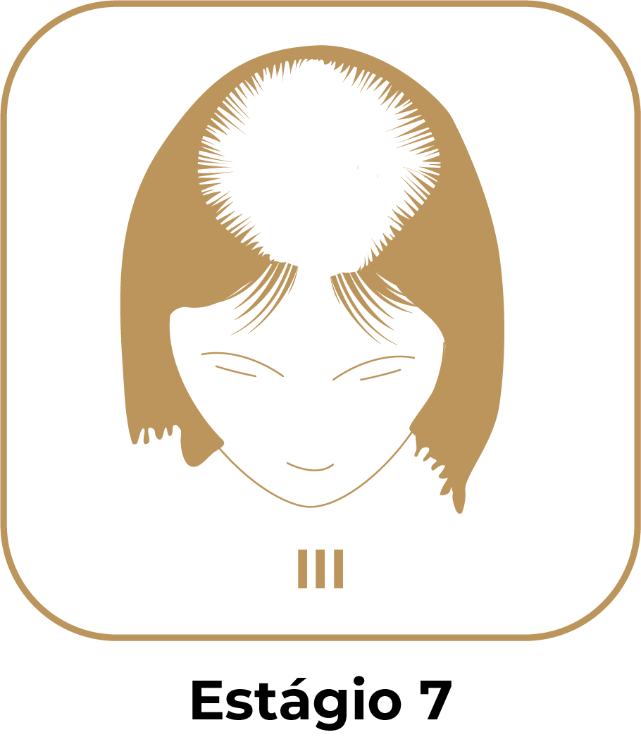 Estágio 7
